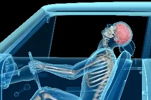 X-ray-like graphic of person in car crash